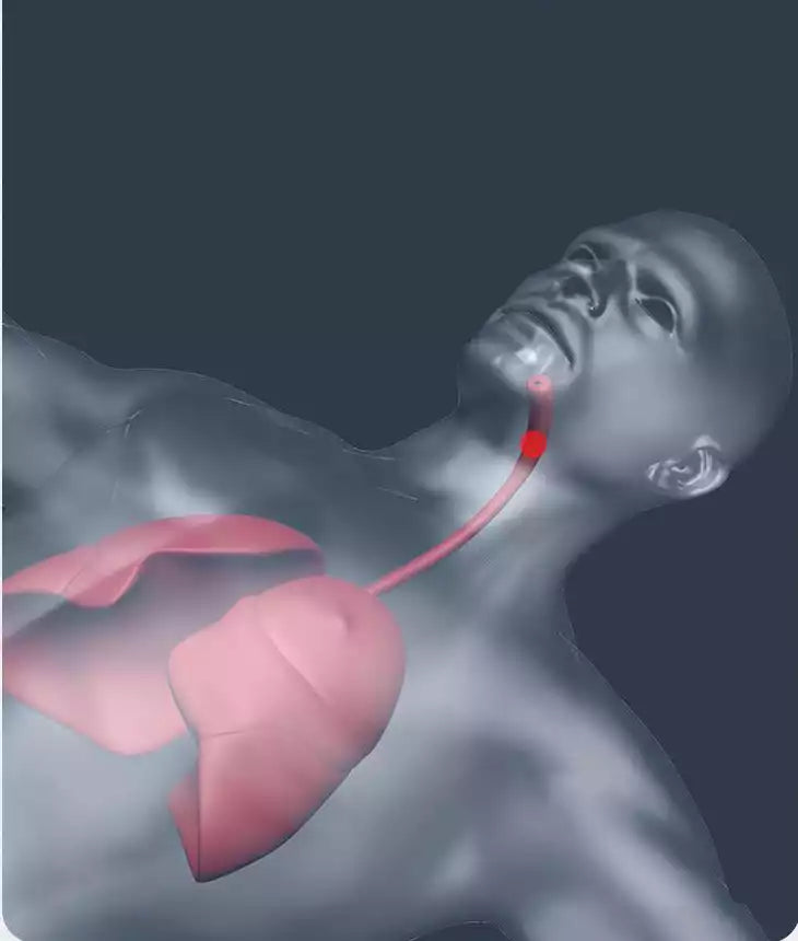 Medical airway suction process diagram